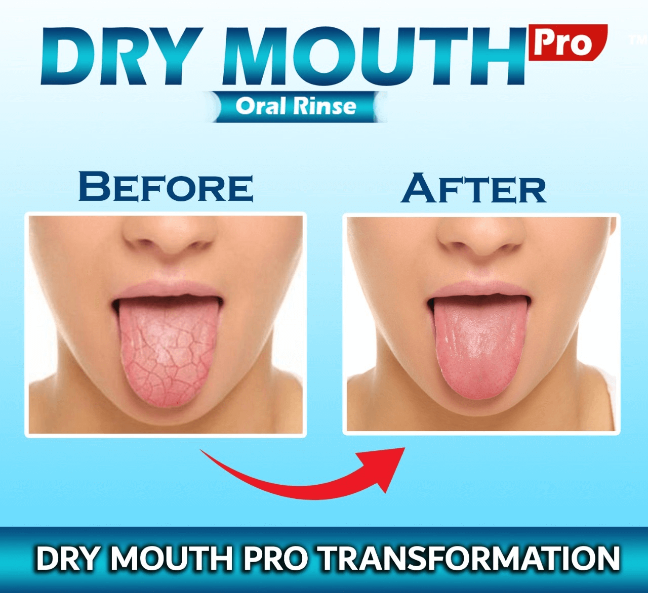 how to cure dry mouth