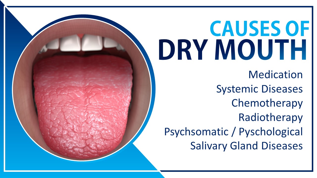 What makes dry mouth go away