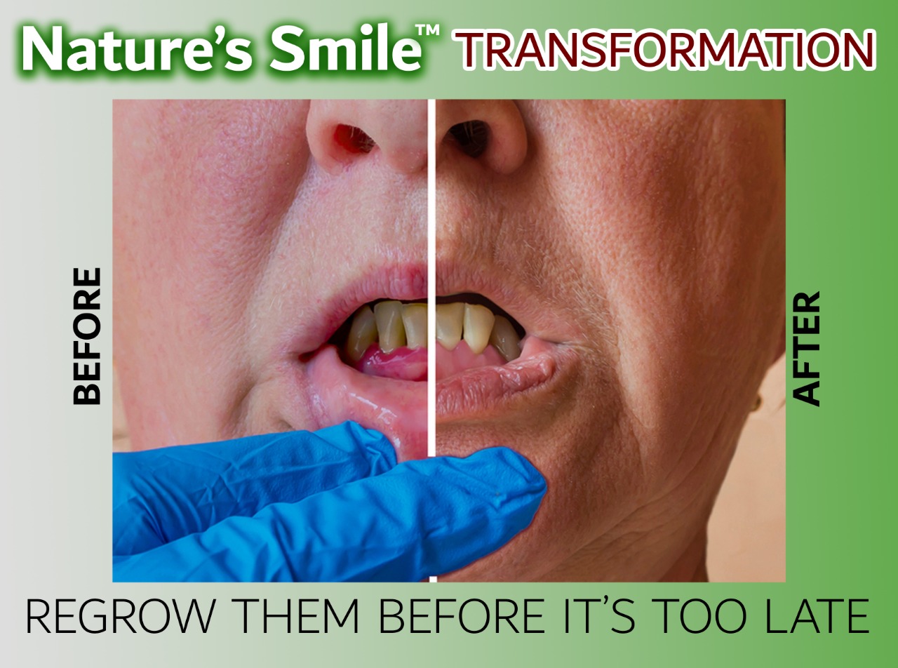 How to Use Natures Smile
