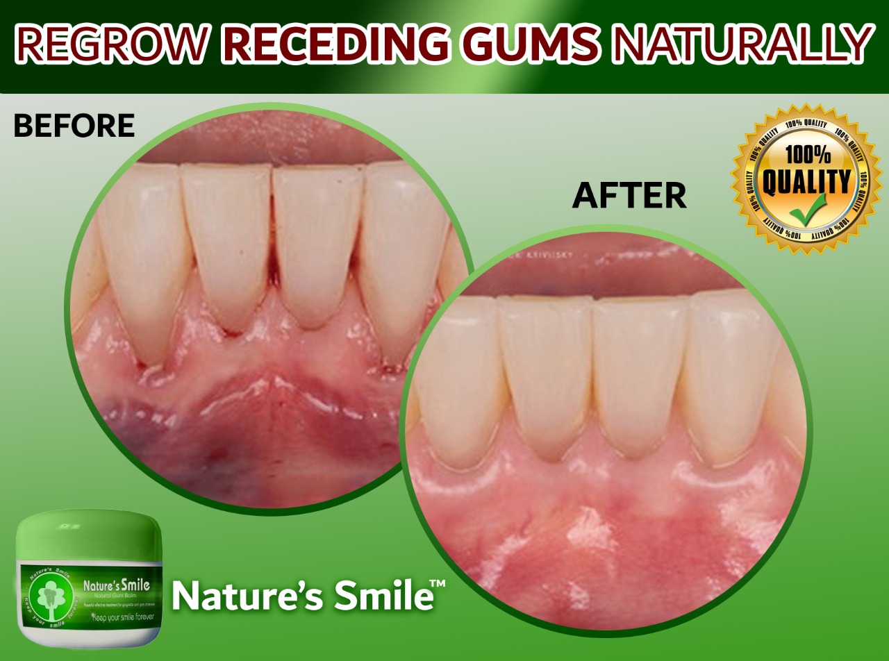 Natures Smile Coupon